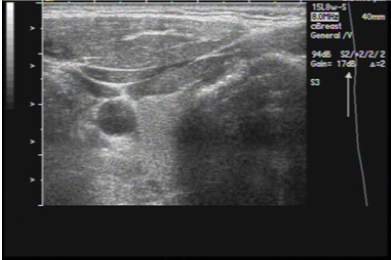 Ultrasound image using default preset