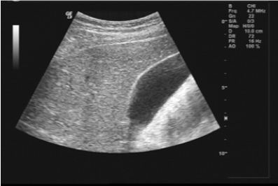 Ultrasound Image with harmonics on