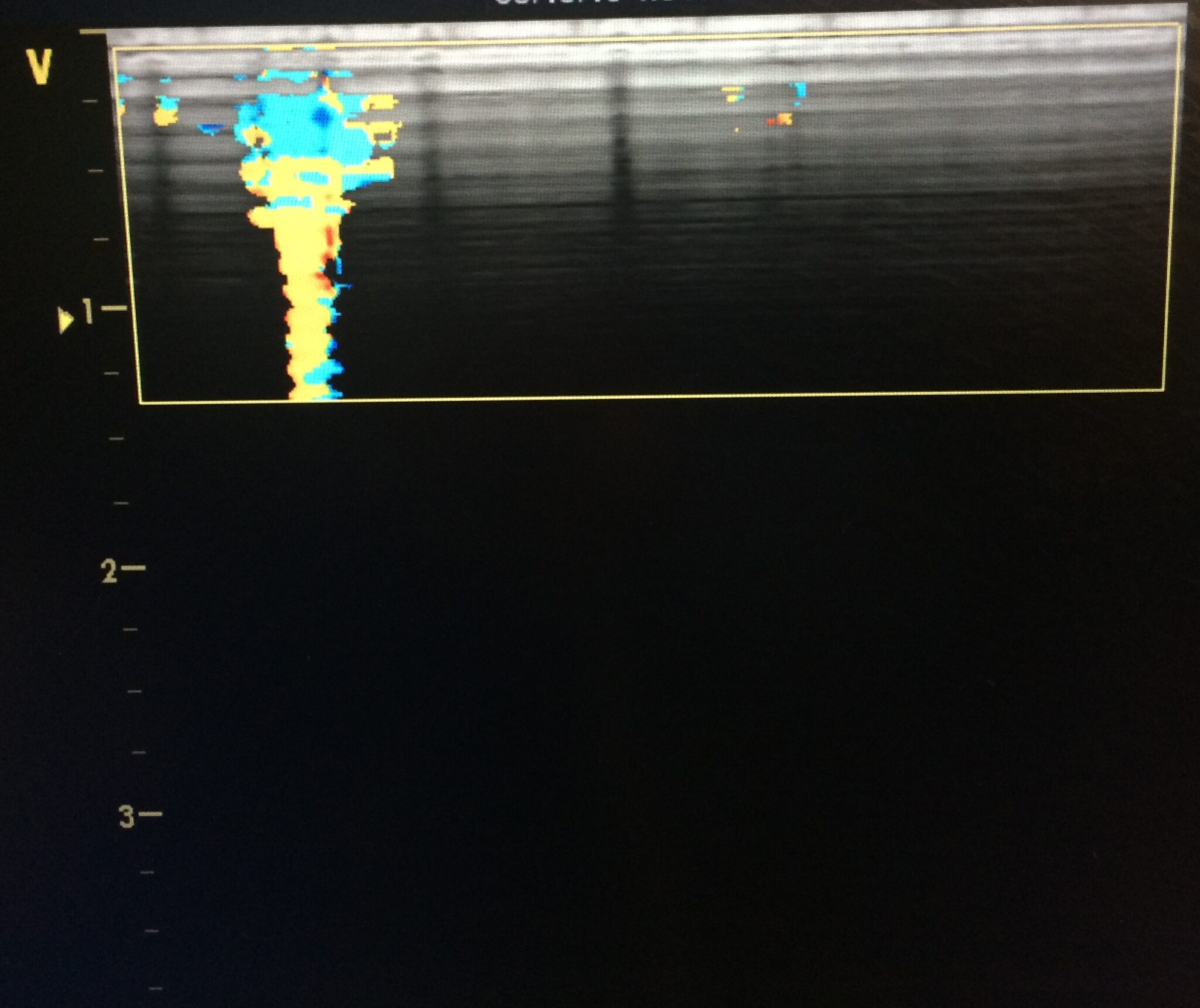 Troubleshooting artifacts in ultrasound images Innovatus Imaging