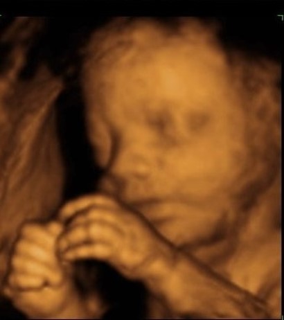 Static 3D Image of a baby